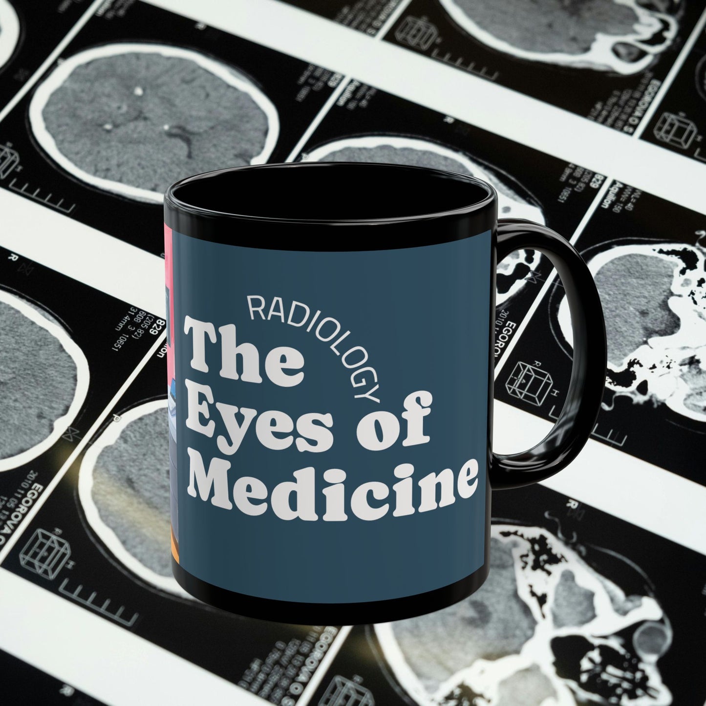 The Eyes of Medicine Radiology Coffee Mug - 11oz - Perfect Gift for Healthcare Professionals