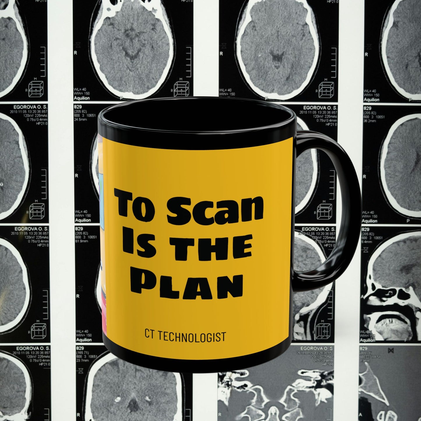 To Scan is the Plan CT Technologist Coffee Mug - 11oz - Perfect Gift for Healthcare Professionals