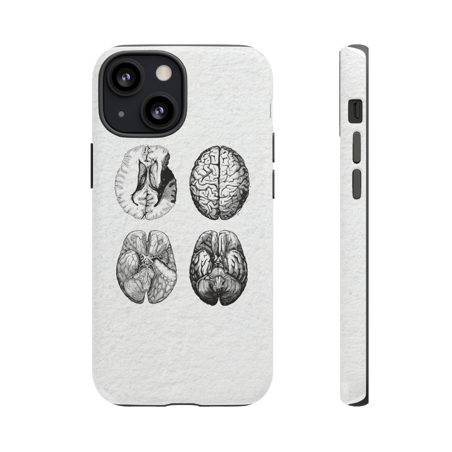 MRI Brain Tough iPhone Cases