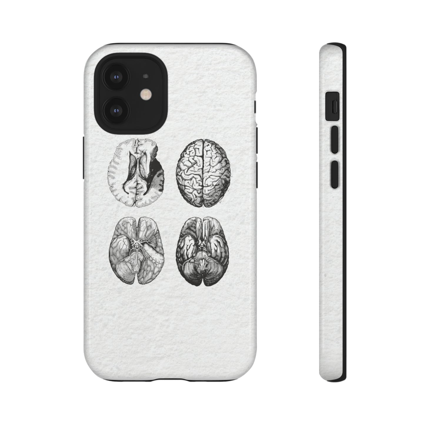 MRI Brain Tough iPhone Cases