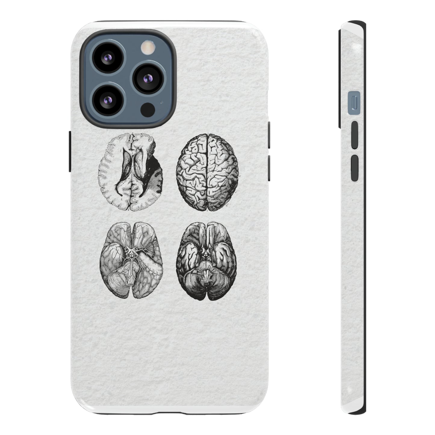 MRI Brain Tough iPhone Cases