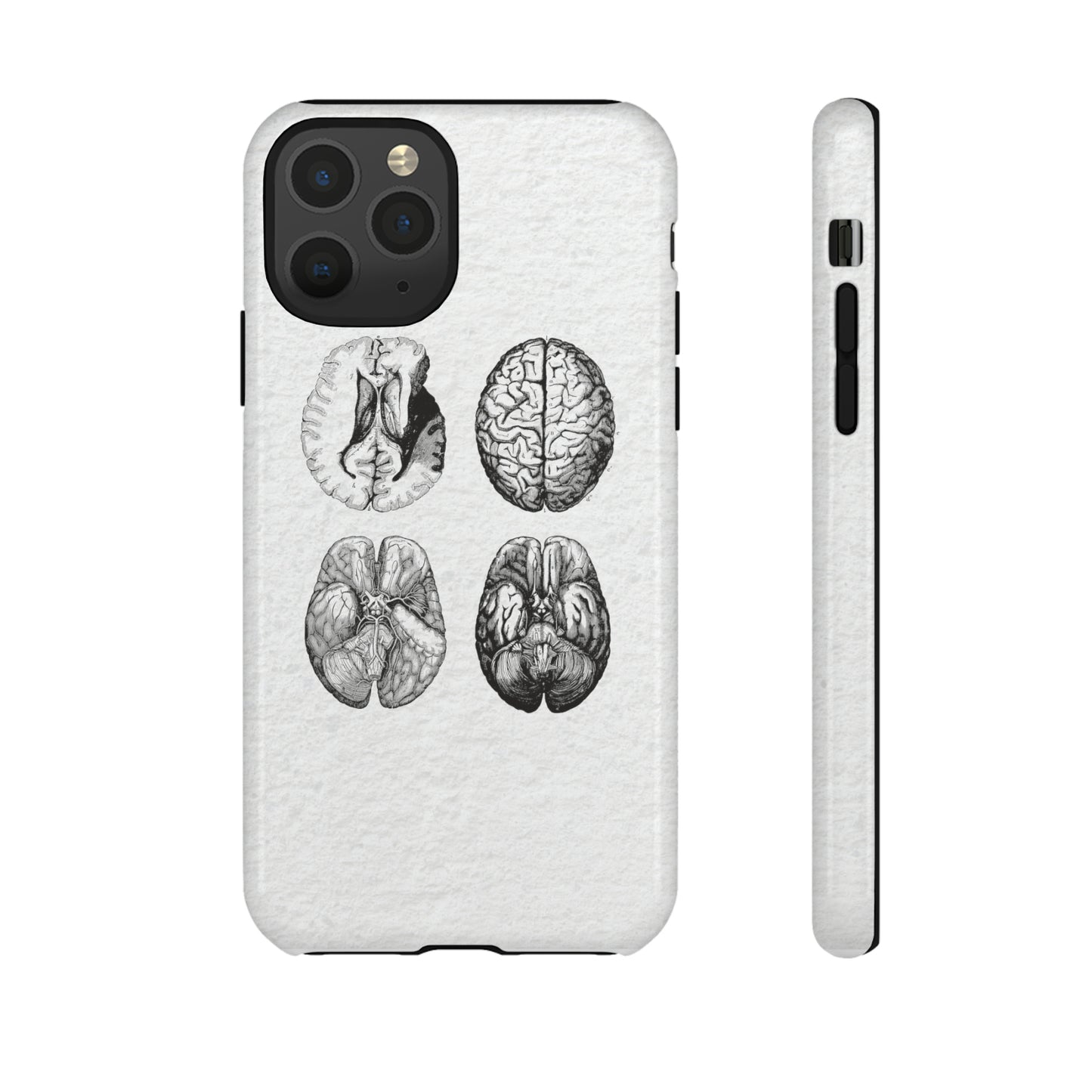 MRI Brain Tough iPhone Cases