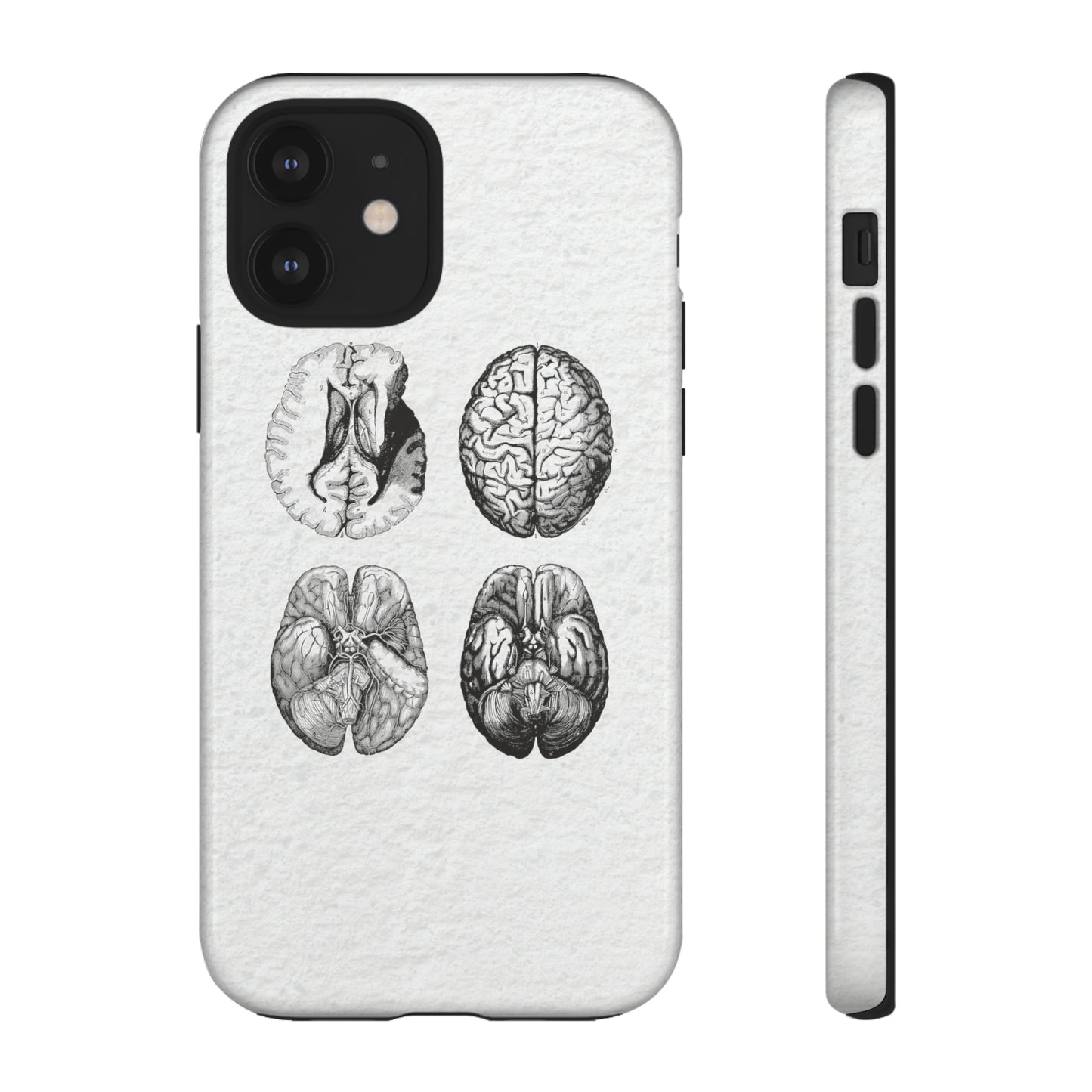 MRI Brain Tough iPhone Cases