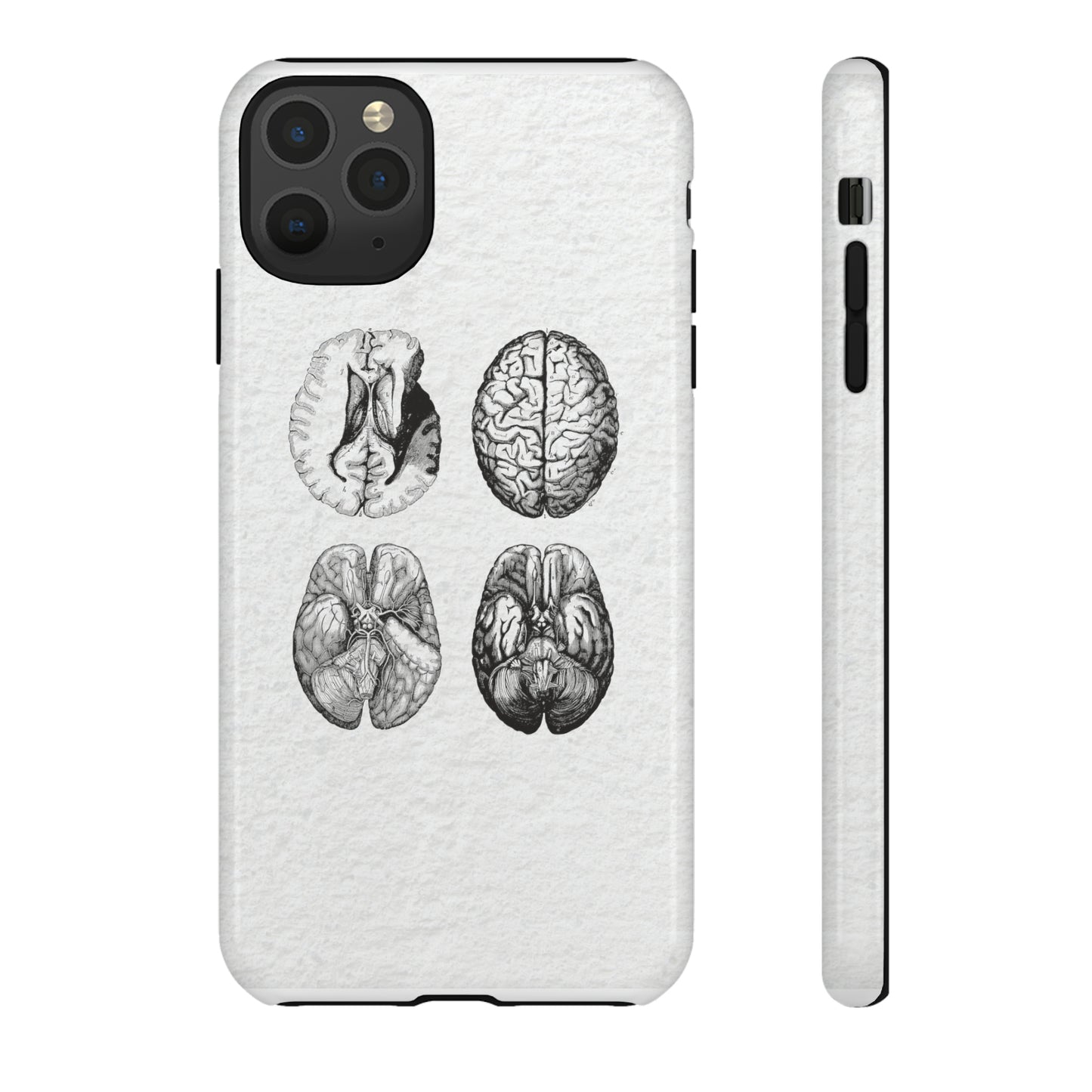 MRI Brain Tough iPhone Cases