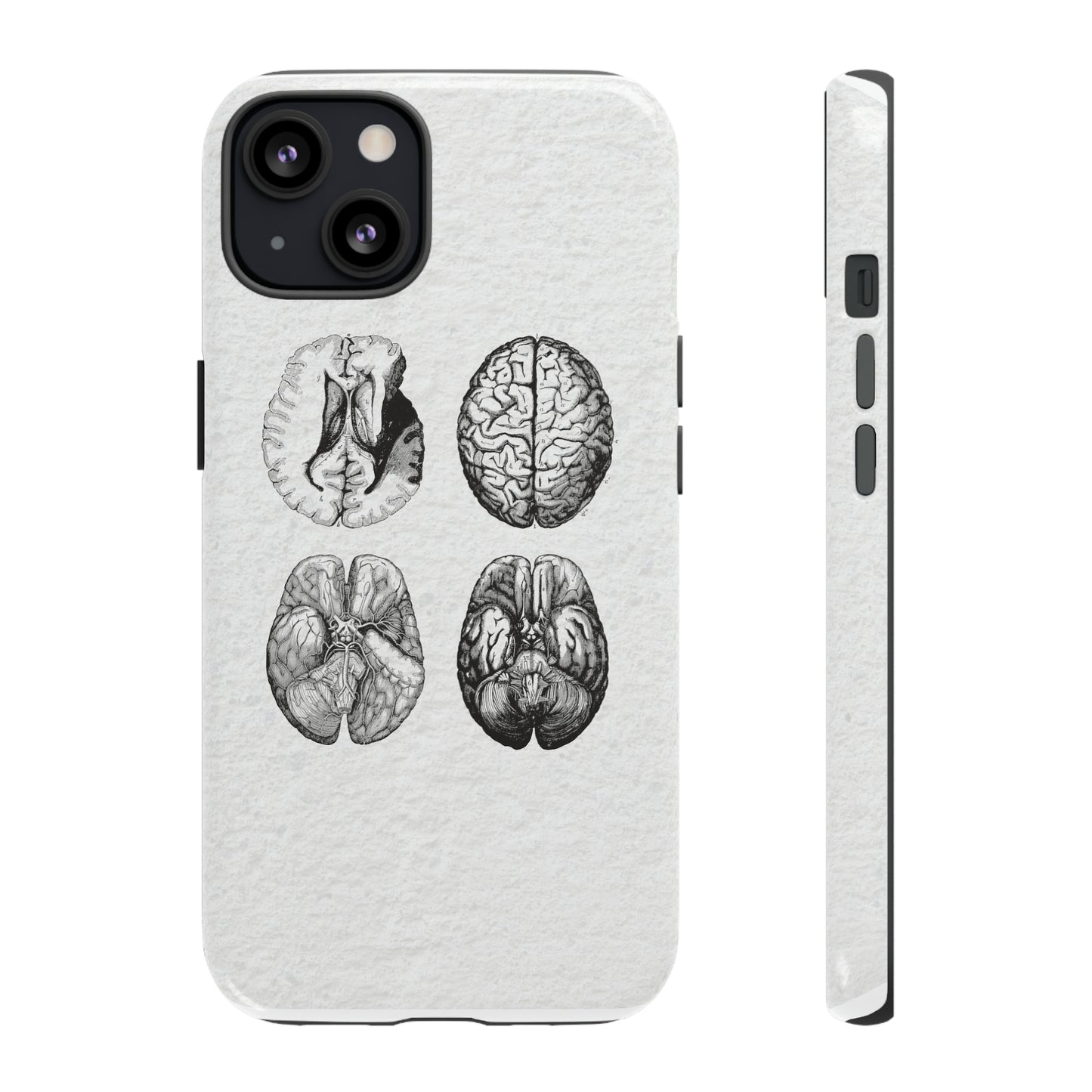 MRI Brain Tough iPhone Cases