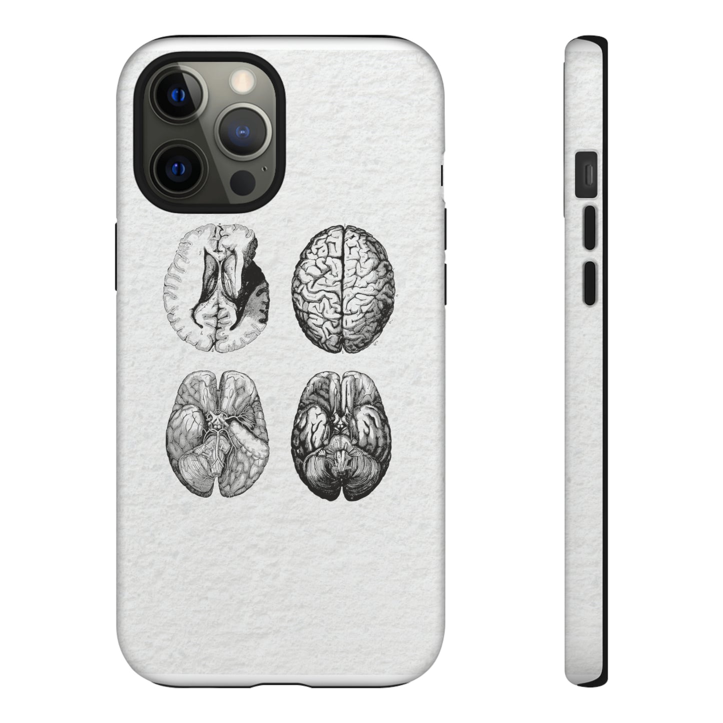 MRI Brain Tough iPhone Cases