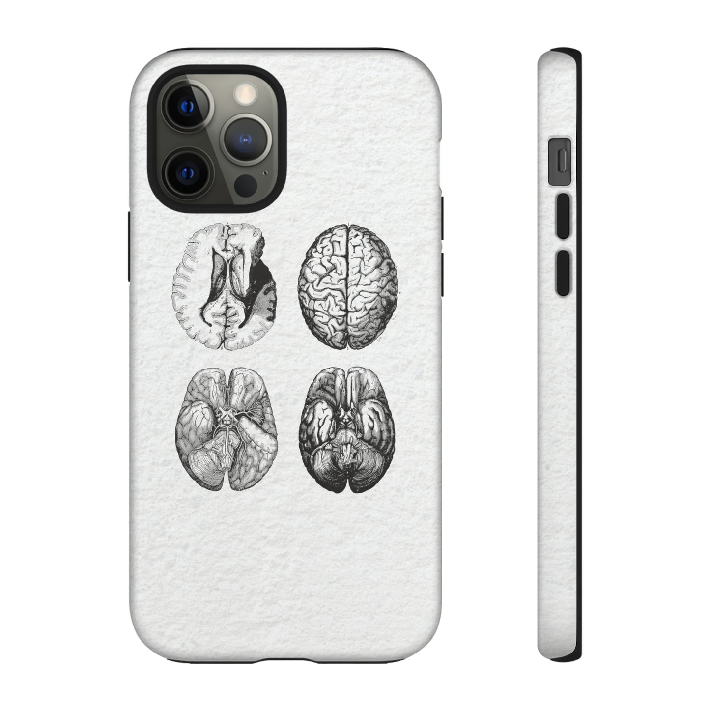 MRI Brain Tough iPhone Cases