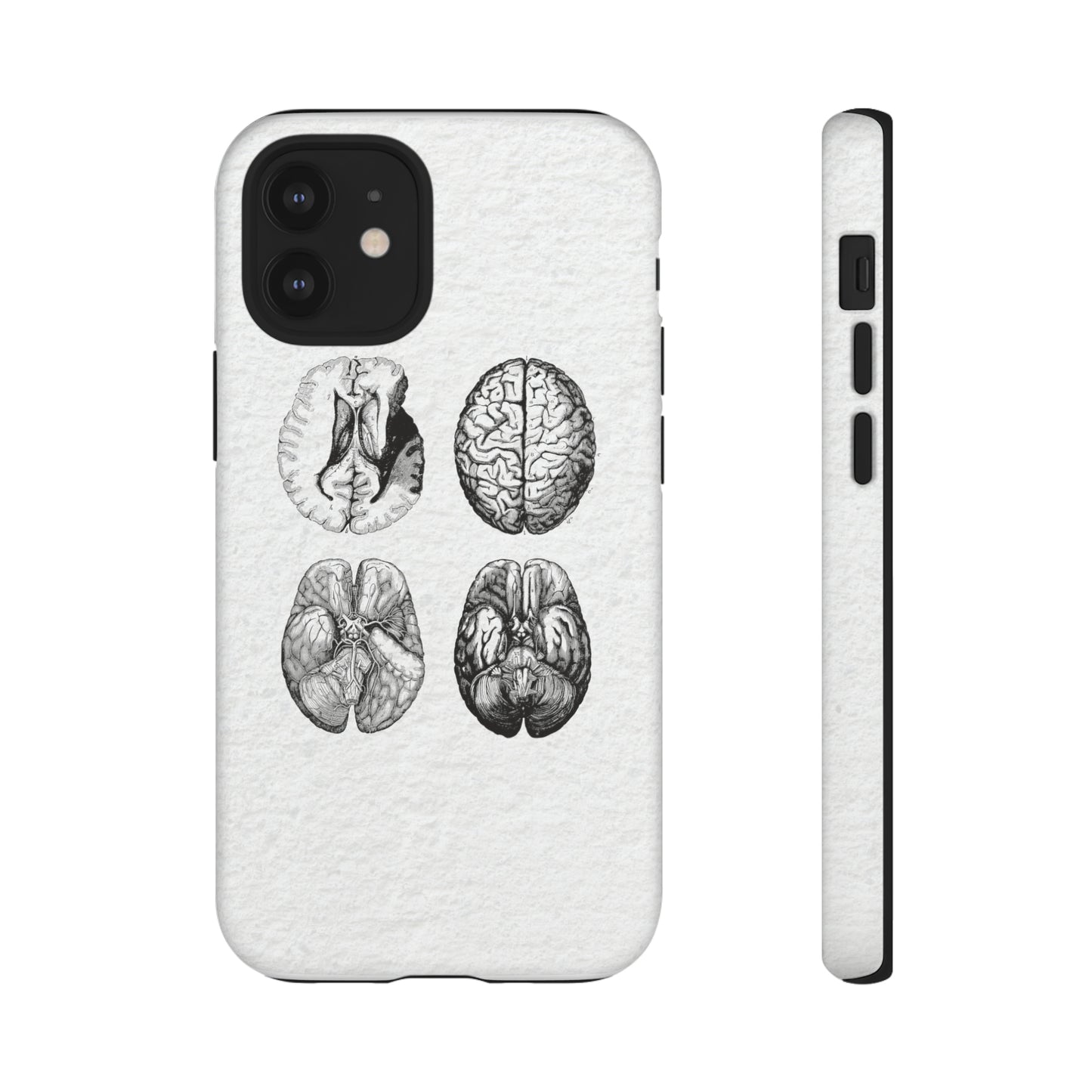 MRI Brain Tough iPhone Cases