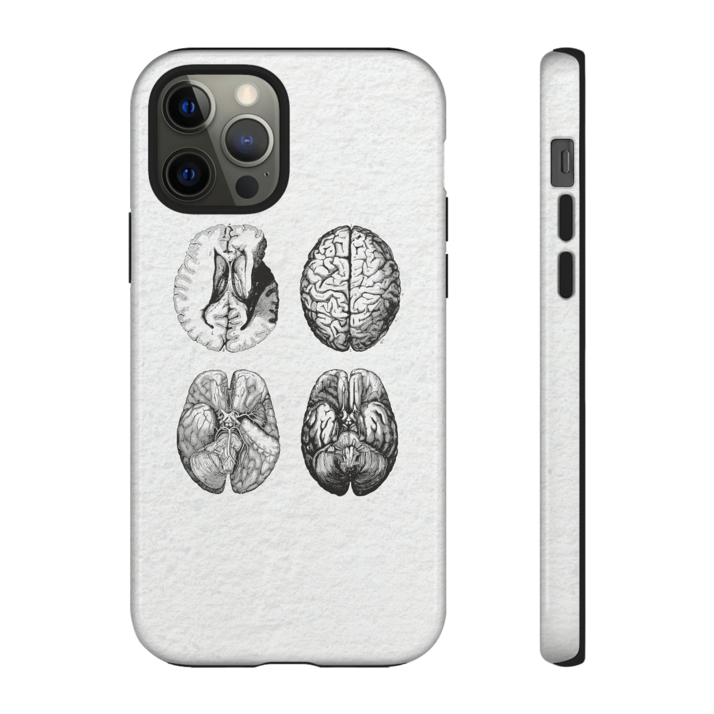 MRI Brain Tough iPhone Cases