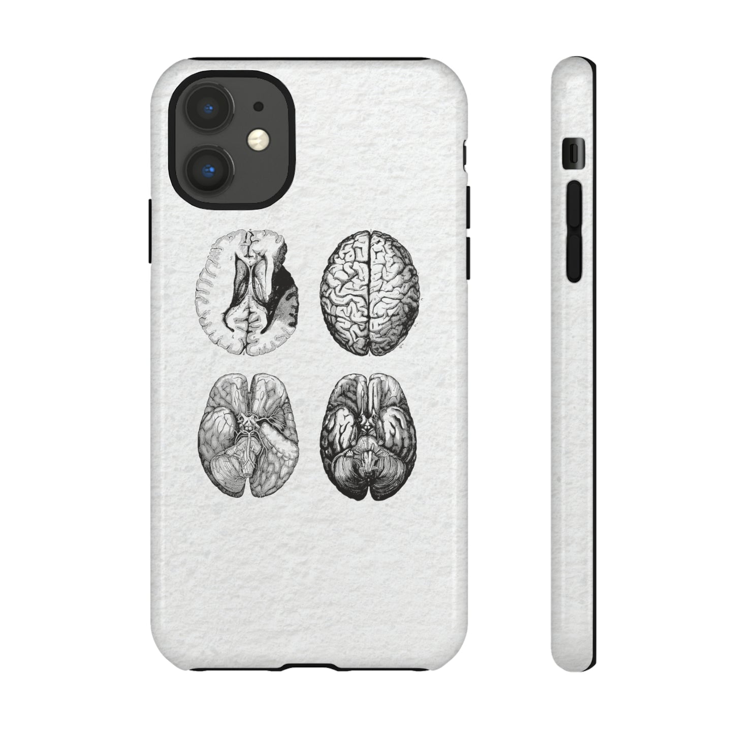 MRI Brain Tough iPhone Cases